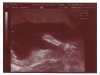 ultrasound001
