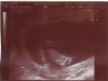 ultrasound004