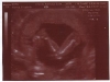 ultrasound005