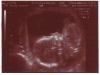 ultrasound006