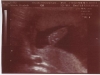 ultrasound007