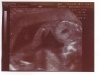 ultrasound009