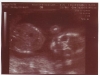 ultrasound010